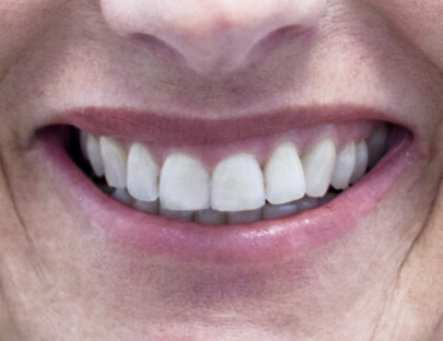an up close image of straight and white teeth