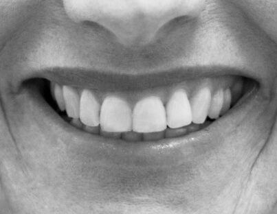 an up close image of straight and white teeth in black and white